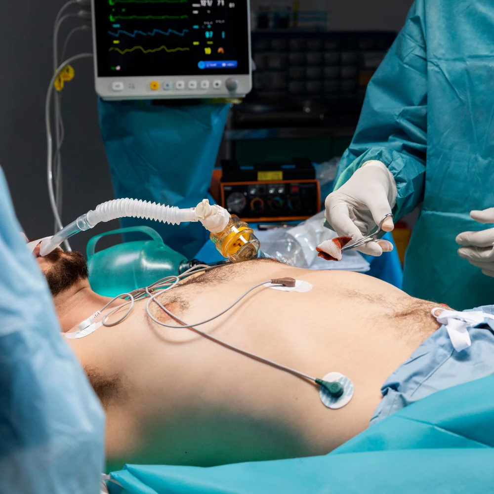 Appendectomy
