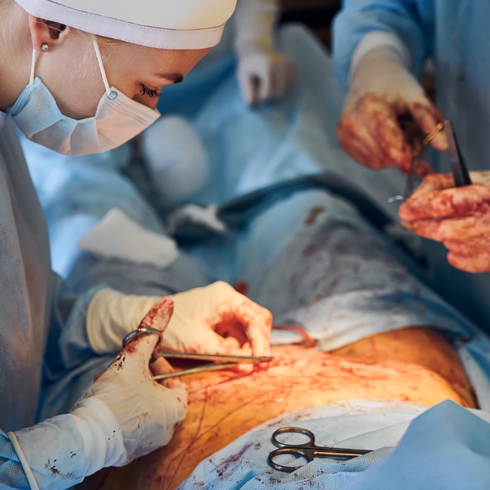 Hernia Surgery